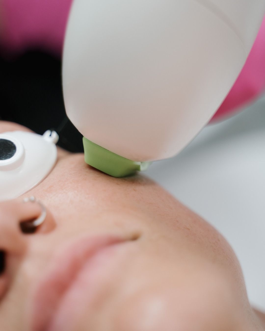 Crown Point Med spa model undergoing facial treatment